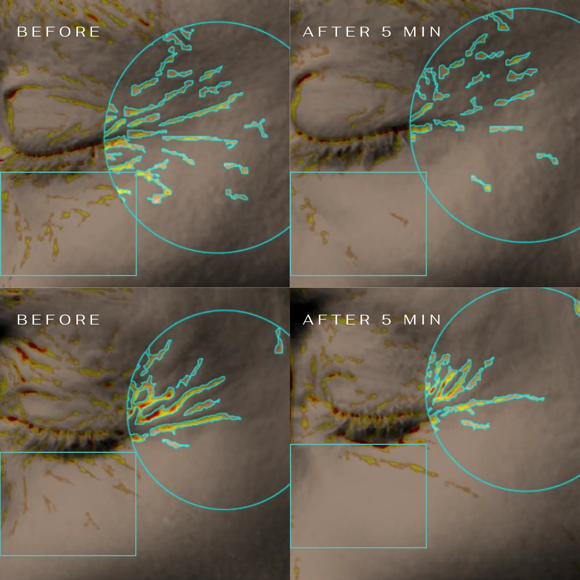 CLM 5 Minute Revolution paakių padeliai
