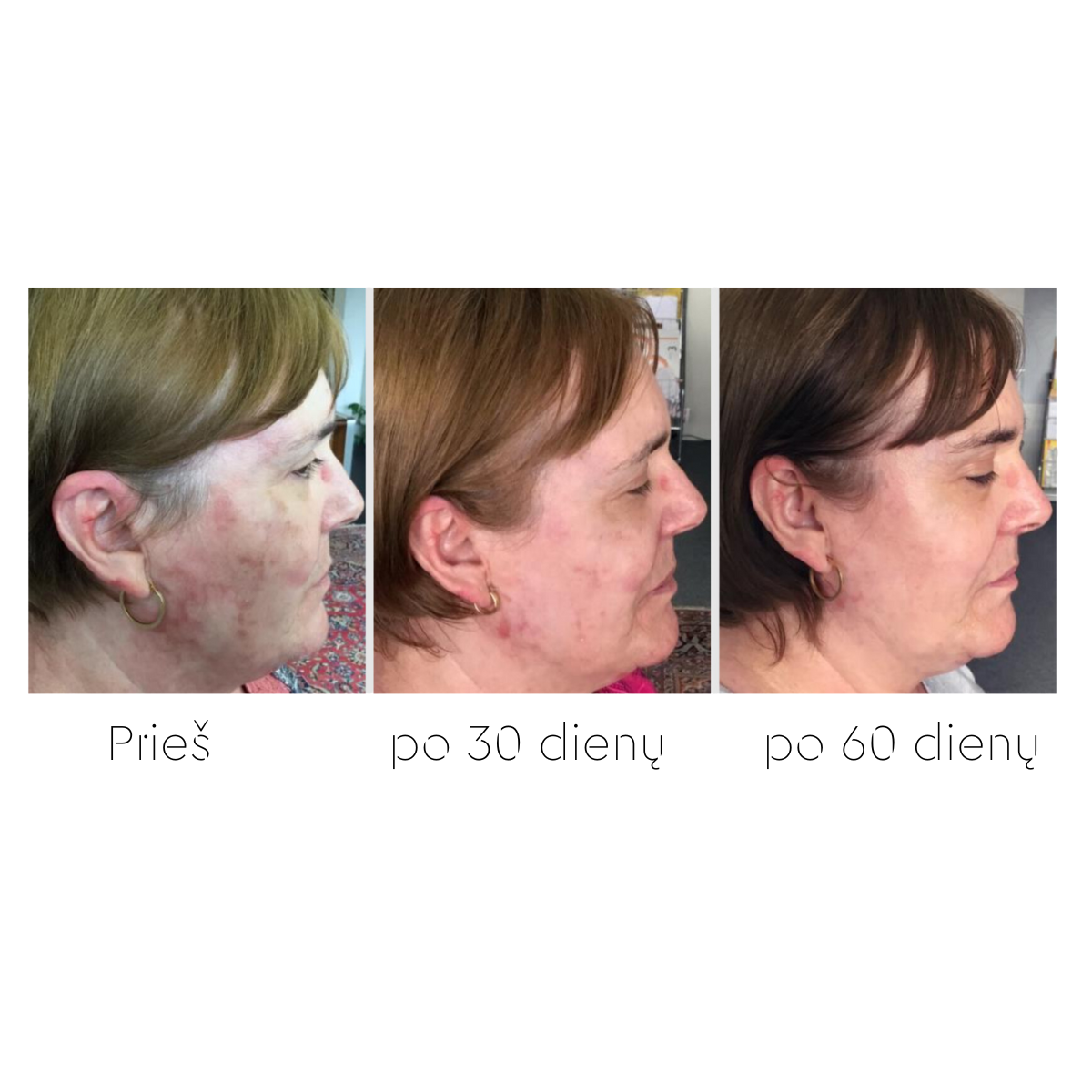 CHOLLEY PHYTOBIOTECH senėjimą stabdantis atkuriamasis kremas 50 ml